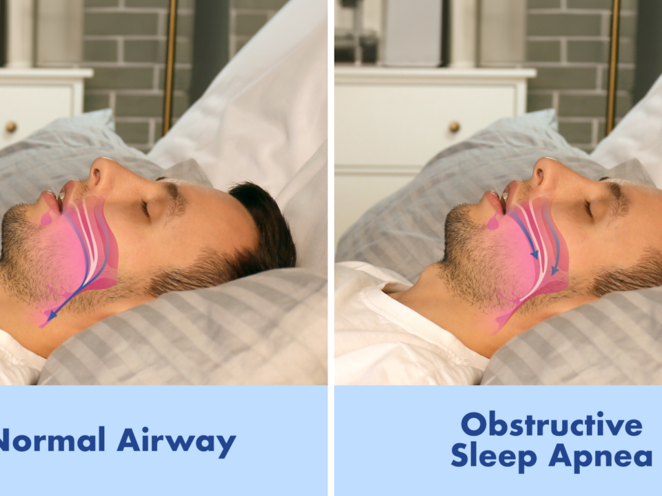 what is cpap therapy a comprehensive guide for sleep apnea patients